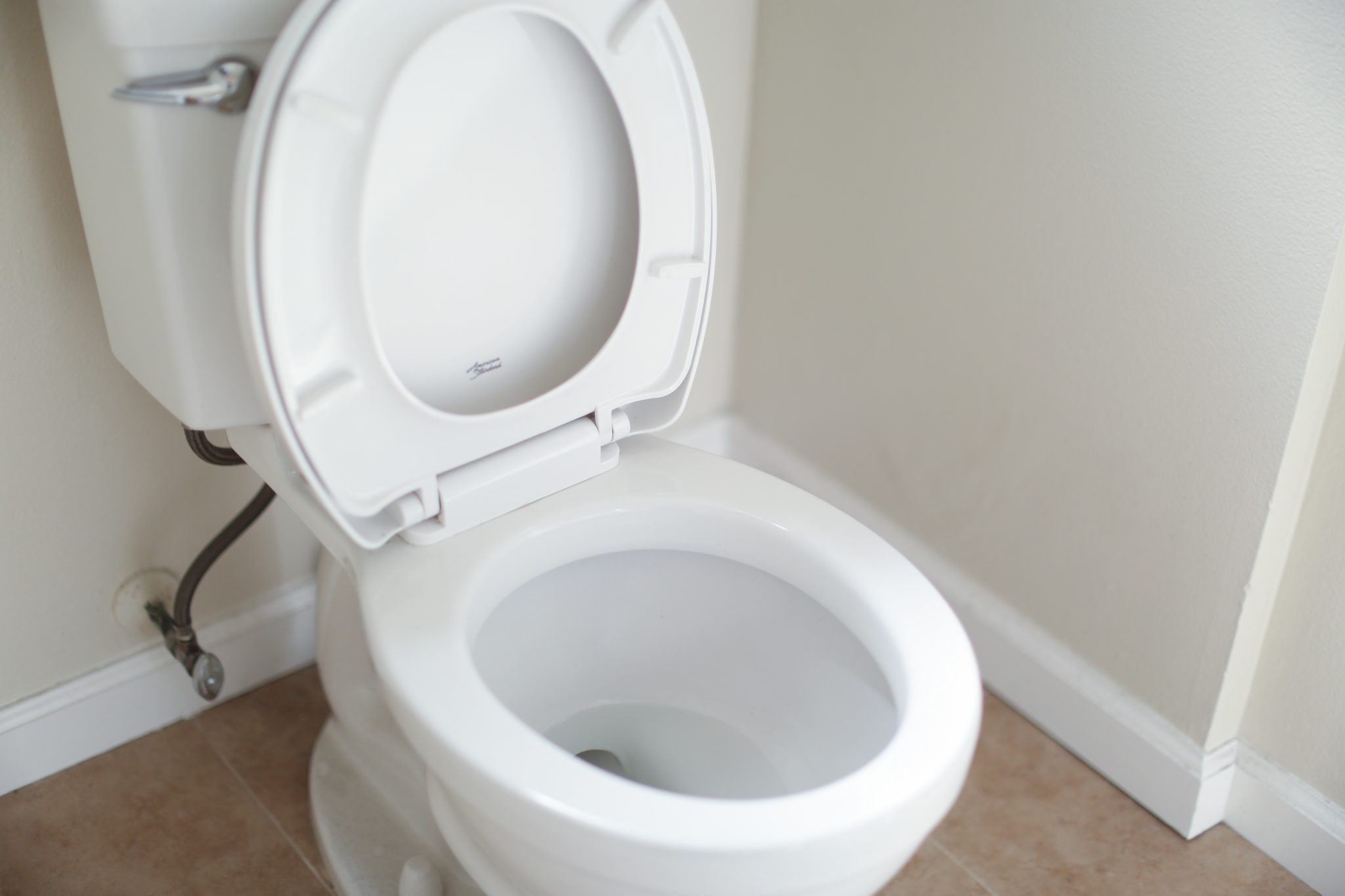 6 Top Ways to Clean a Badly Stained toilet
