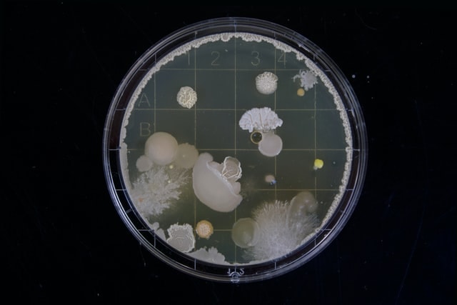 bacteria growing in agar plate