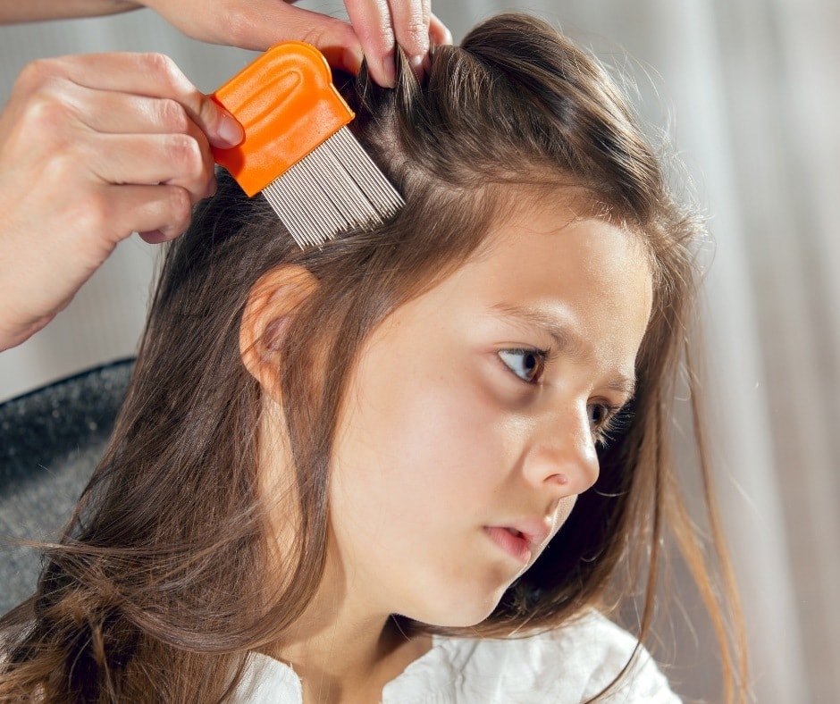 Lice is common among children