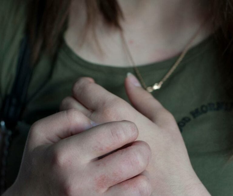 Can You Get Scabies From Furniture?